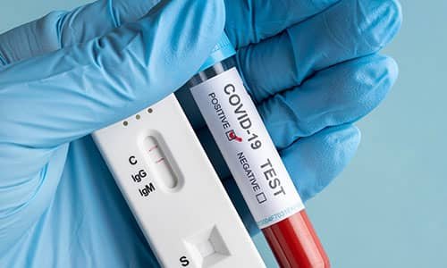  Effortless Covid Vaccination
