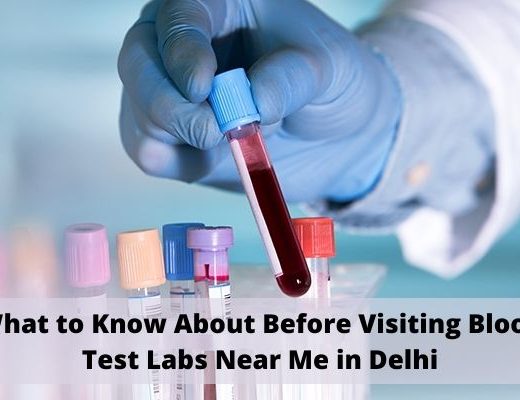 Blood Test Labs Near Me