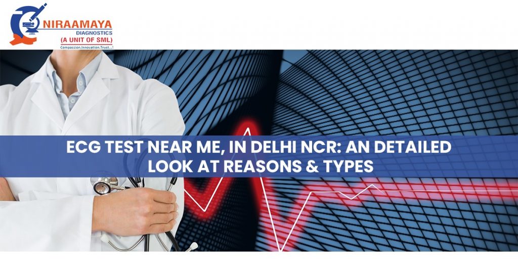 ECG Test Near Me, In Delhi NCR An Detailed Look At Reasons & Types