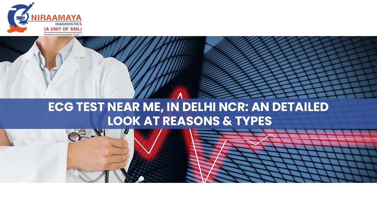 ECG Test Near Me, In Delhi NCR: An Detailed Look At Reasons & Types