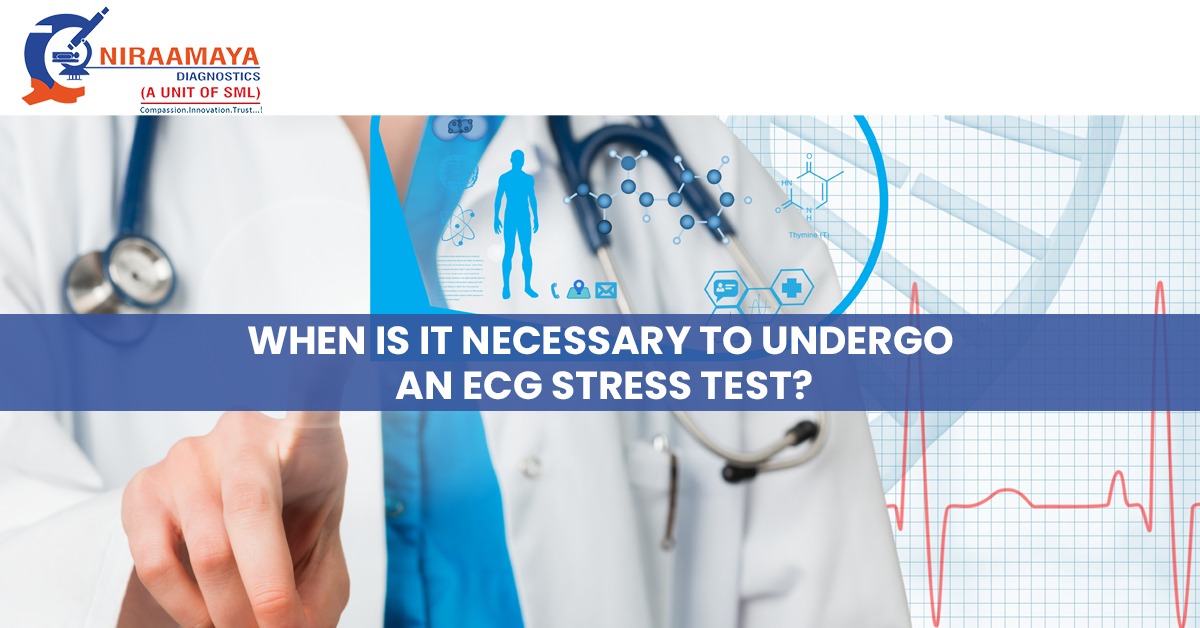 When is it Necessary to Undergo an ECG Stress Test