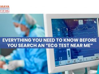 Everything You Need To Know Before You Search an “ECG Test near Me”