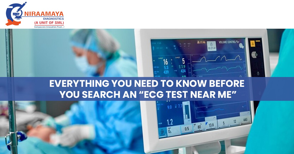 Everything You Need To Know Before You Search an “ECG Test near Me”