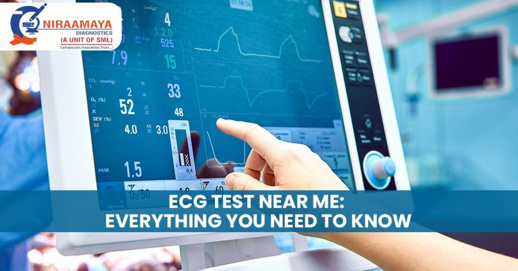 ECG Test near Me Everything You Need to Know Niraamaya Diagnostics