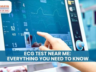 ECG Test near Me: Everything You Need to Know