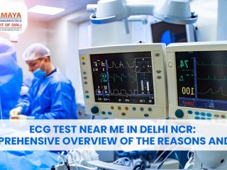 ECG Test Near Me in Delhi NCR: A Comprehensive Overview of the Reasons and Types