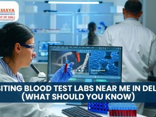 Visiting Blood Test Labs Near Me In Delhi? (What Should You Know)