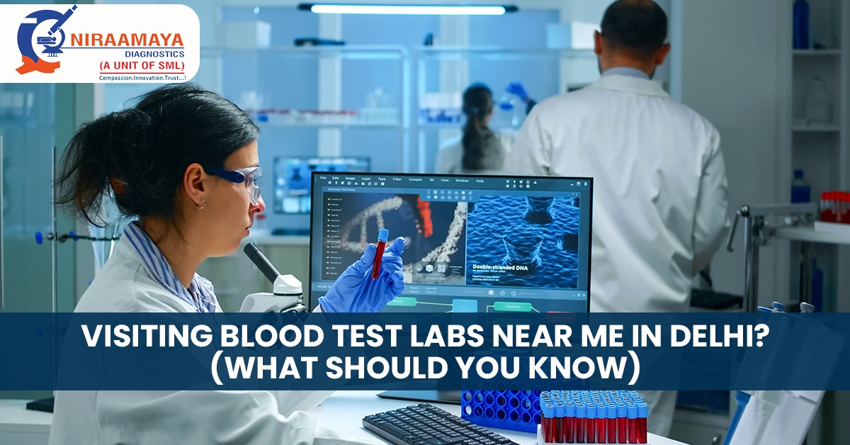 Visiting Blood Test Labs Near Me In Delhi? (What Should You Know)