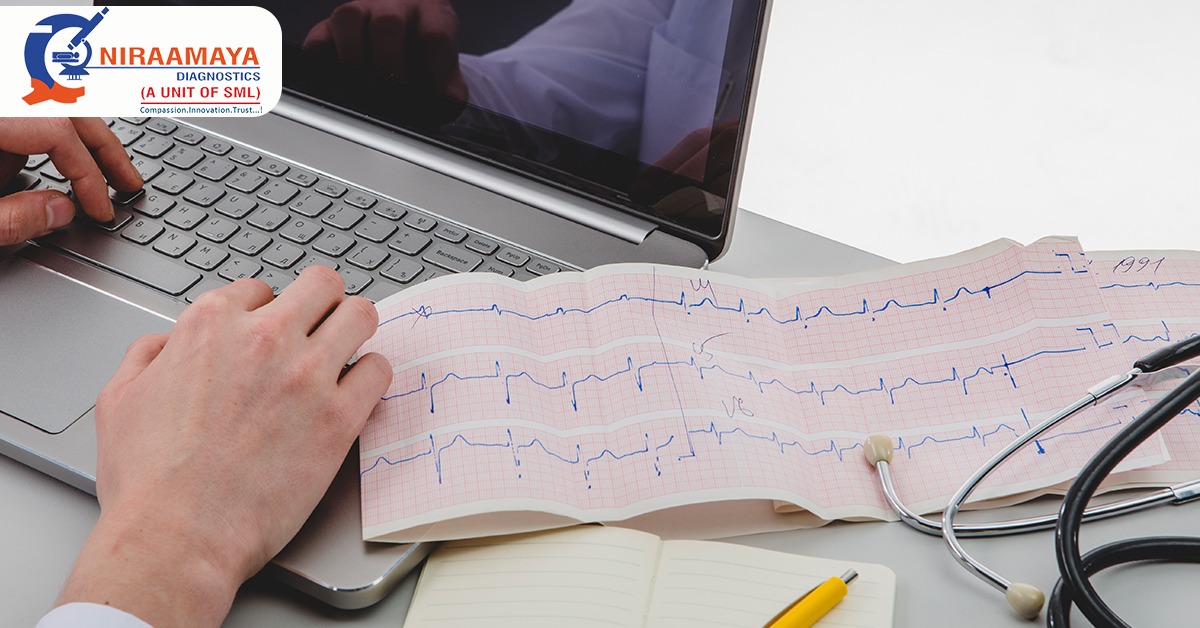 Why ECG Is Important For Heart Patient?