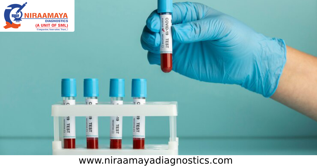 blood test labs